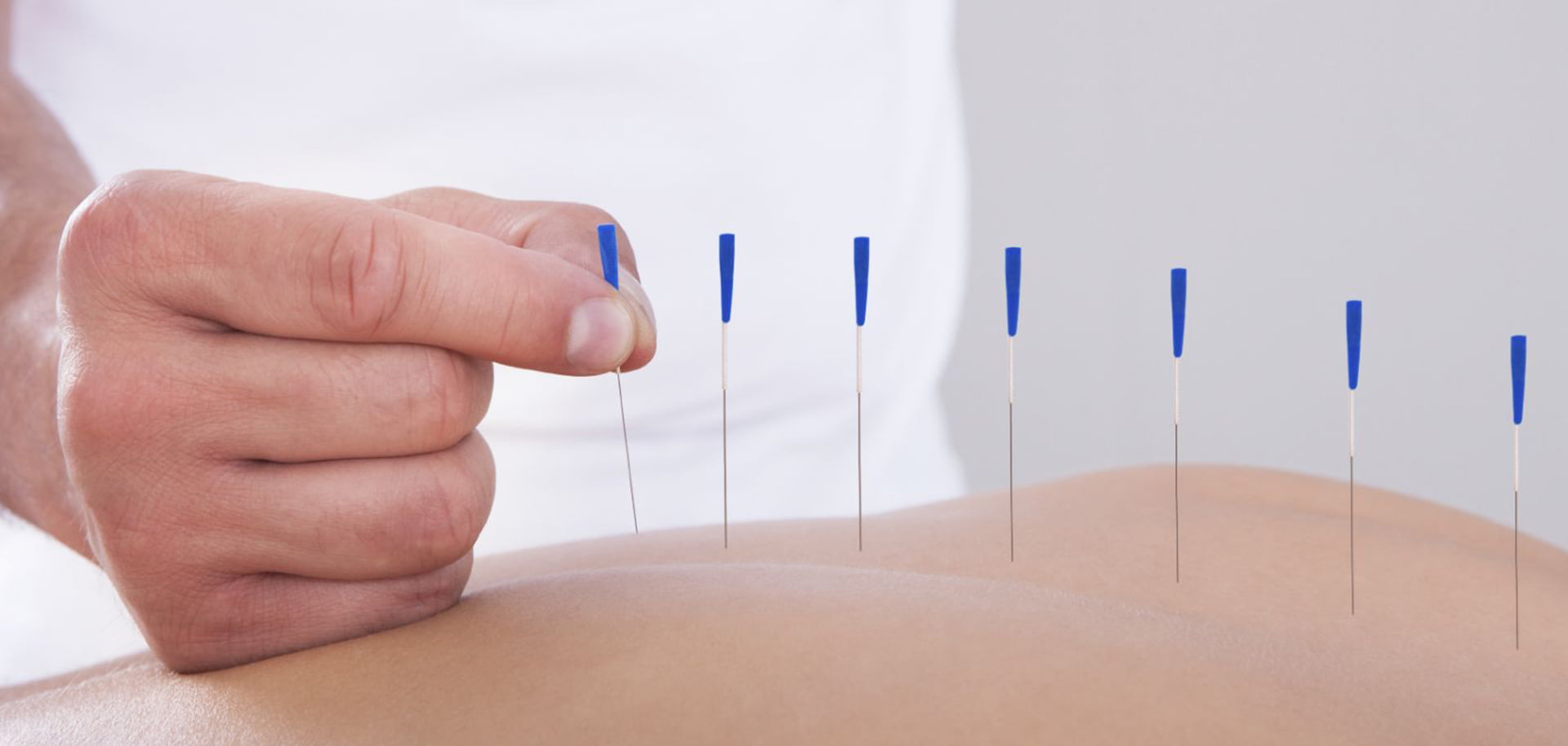 Akupunktura - Fizijatar Novi Sad | Fizikalna terapija i ortopedija |  Poliklinika Galetić